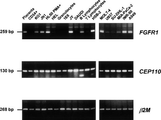 Fig. 3. Expression of FGFR1 and CEP110 genes. / RT-PCR products were obtained from a variety of tissues and normal and tumoral hematopoietic cells (listed in “Materials and Methods”) using specific primer pairs of each gene (FGFR1, FA-F9.2; CEP110, CEPF-CEPR; see Table 1). Each panel is a photograph of the ethidium bromide-stained agarose gel in which PCR products were electrophoresed. β2 Microglobulin (β2 mol/L) amplification was used to estimate the efficiency of RT-PCR reactions. Labels of the source of the material and PCR product sizes are indicated at the top of rows and on the left, respectively.