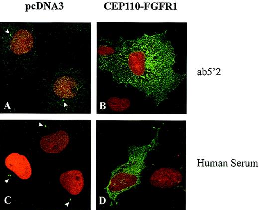 Fig. 8. Immunolocalization of endogenous CEP110 and CEP110-FGFR1 fusion protein. / Cos-1 cells transfected with the expression vector pcDNA3, either empty (A, C) or containing CEP110-FGFR1 fusion cDNA (B, D), were subjected to double- immunofluorescence staining with anti-CEP110 antibodies (Ab5′2 and human immune serum), revealed by Alexa-conjugated antirabbit (for Ab5′2) or FITC-conjugated antihuman (for human serum) secondary antibodies and 7-AAD to visualize endogenous CEP110 (arrowheads) and CEP110-FGFR1 (both in green) and the DNA (in red), respectively. Magnification, × 1000.