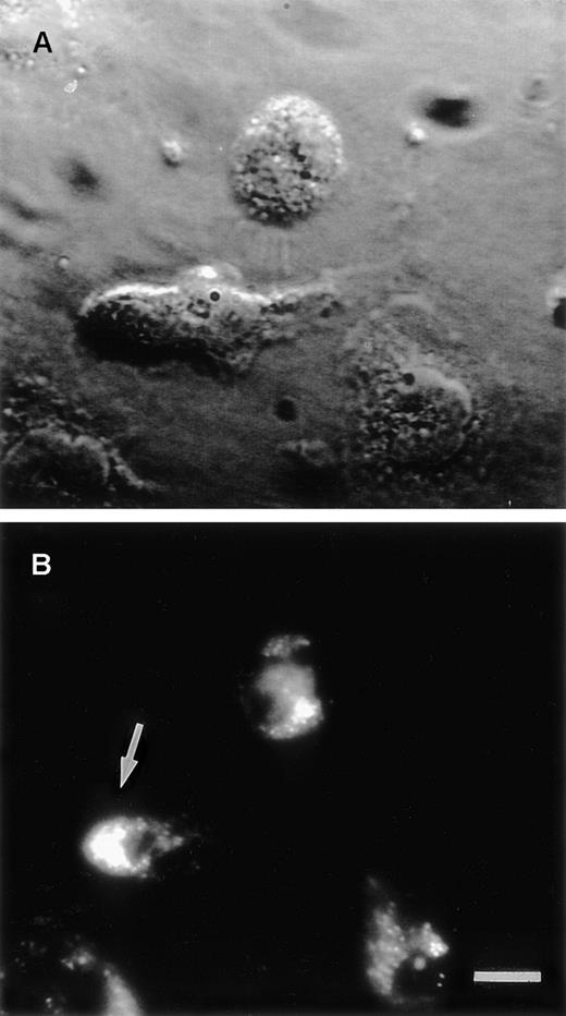Fig. 2. Stimulated human PMN. / (A) Enhanced transmitted light image of fMLP (10−7mol/L)-stimulated human PMN adhering to collagen. (B) Corresponding image in laser-emitted fluorescent light showing immunofluorescent staining for α2β1. Combined examination of cell morphology and α2β1 integrin expression revealed that the receptor was localized to the lamellipodium in the front of PMN having a distinct head-tail morphology (arrow). Bar indicates 5 μm.