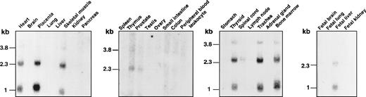 Fig. 5. Tissue distribution of the XG transcripts. / Human multiple-tissue Northern blots from Clontech were hybridized under high-stringency conditions with the 32P-labeledXG cDNA probe and autoradiographed.