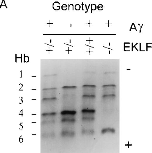 Fig. 2. Efficient generation of hybrid human-mouse hemoglobin in mice expressing the μLCR-Aγ transgene. / (A) Isoelectric focusing of hemolysates from E15 embryos revealed hybrid human-mouse hemoglobins. Presence (+) or absence (−) of the μLCR-Aγ transgene and the EKLF genotype (± or −/− ) is indicated above each lane. Six hemoglobin (Hb) bands were identifiable, labeled 1 to 6, according to migration from anode to cathode. Hemoglobins 1 and 3 were detectable only in mice that harbored the μLCR-Aγ transgene. They were equally prevalent in EKLF−/− (lane 4) and± embryos (lanes 1 and 3). Bands 4 and 5 represent murine β-major and β-minor hemoglobin, respectively; each was markedly and selectively reduced in EKLF−/− blood. The direction of the anode and cathode is indicated. (B, C) Electrospray mass spectroscopy on gel-purified bands 1 and 3. Hemoglobin band 1 (B) contained 2 proteins of 16 009 and 16 146 kd, which correspond to the predicted molecular weights of human Aγ-globin and murine ζ-globin, respectively. Hemoglobin band 3 (C) contained proteins whose molecular masses were consistent with murine α globins, α 1 (Mr 14 981.0), α 5 (Mr 14 995.0), and human Aγ globin (Mr 16 009.3). (D) Reverse-phase HPLC separation of globins expressed by animal 3 in A (genotype EKLF+/+ Aγ+). Peaks annotated with dots represent artefacts of sample storage (single dot, mixed disulfides of murine β-major and β-minor with either cysteine of glutathione; double dot, disulfide-linked murine β-globin dimers).