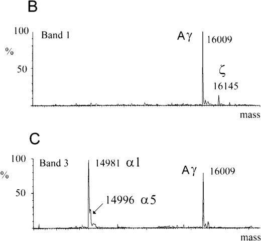 Fig. 2. Efficient generation of hybrid human-mouse hemoglobin in mice expressing the μLCR-Aγ transgene. / (A) Isoelectric focusing of hemolysates from E15 embryos revealed hybrid human-mouse hemoglobins. Presence (+) or absence (−) of the μLCR-Aγ transgene and the EKLF genotype (± or −/− ) is indicated above each lane. Six hemoglobin (Hb) bands were identifiable, labeled 1 to 6, according to migration from anode to cathode. Hemoglobins 1 and 3 were detectable only in mice that harbored the μLCR-Aγ transgene. They were equally prevalent in EKLF−/− (lane 4) and± embryos (lanes 1 and 3). Bands 4 and 5 represent murine β-major and β-minor hemoglobin, respectively; each was markedly and selectively reduced in EKLF−/− blood. The direction of the anode and cathode is indicated. (B, C) Electrospray mass spectroscopy on gel-purified bands 1 and 3. Hemoglobin band 1 (B) contained 2 proteins of 16 009 and 16 146 kd, which correspond to the predicted molecular weights of human Aγ-globin and murine ζ-globin, respectively. Hemoglobin band 3 (C) contained proteins whose molecular masses were consistent with murine α globins, α 1 (Mr 14 981.0), α 5 (Mr 14 995.0), and human Aγ globin (Mr 16 009.3). (D) Reverse-phase HPLC separation of globins expressed by animal 3 in A (genotype EKLF+/+ Aγ+). Peaks annotated with dots represent artefacts of sample storage (single dot, mixed disulfides of murine β-major and β-minor with either cysteine of glutathione; double dot, disulfide-linked murine β-globin dimers).