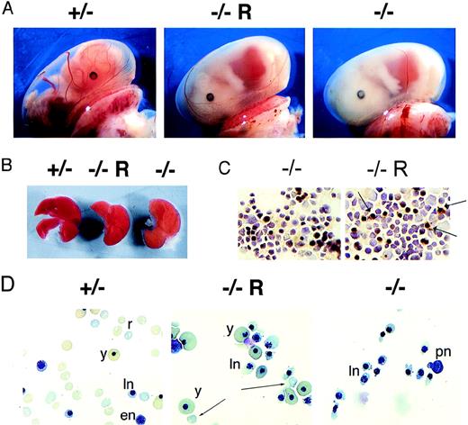 Fig. 3. Improvement in hemoglobinization but persistent hemolysis in EKLF−/− embryos. / (A) Photographs of a litter of E15 embryos (magnification ×10). The EKLF genotype (± and −/− ) and the presence of the transgene (R) are indicated above each photograph. (B) Slight improvement in the crimson hue of an EKLF−/−fetal liver that harbors the μLCR− Aγ+transgene (−/−R) compared to 1 that does not (−/−). (C) Slight improvement in the benzidine staining of EKLF−/− fetal liver cells that harbor the transgene (−/−R) compared with those that do not (−/−). Arrows indicate benzidine-positive cells. (D) May-Gruenwald-Giemsa (MGG) stained cytocentrifuge specimens of the blood from the same 3 embryos depicted in A indicating some rescue in hemoglobinization of fetal liver-derived erythroid cells. However, morphologically abnormal nucleated erythrocytes persist. y, yolk sac derived nucleated red cells; PN, pronormoblast; en, early normoblast; ln, late normoblast; r, fetal liver-derived enucleate red cell. Arrows indicate occasional enucleate red cells in EKLF−/− , μLCR−Aγ + fetal liver samples.