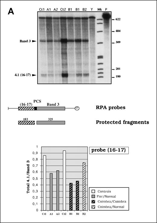 Fig. 2. Quantitative analysis of reticulocyte 4.1R messenger RNA (mRNA). / (A) RNase protection assay. In the top panel is an autoradiograph showing phosphorus 32 (32P)-labeled protected fragments. Mk indicates size marker (32P end-labeled pBR 322 MspI fragments); P, undigested probe; Ct1 and Ct2, control mRNAs; and Y, yeast RNA used as negative control. The middle panel shows a schematic representation of the probe and the expected protected fragments. The bottom panel shows the 4.1R mRNA quantitation measured as a normalized ratio of total 4.1 to band 3. (B) Quantitative RT-PCR using protein 4.2 mRNA as the internal control. Three time points (20, 22, and 24 cycles) were considered. Mk indicates 100-base-pair size marker. Total 4.1R mRNA amounts are presented as ratios of 4.1R to 4.2.