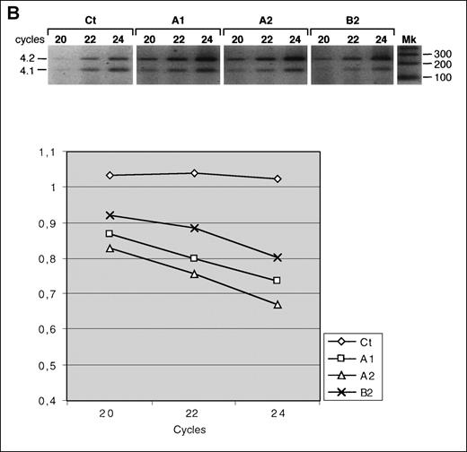 Fig. 2. Quantitative analysis of reticulocyte 4.1R messenger RNA (mRNA). / (A) RNase protection assay. In the top panel is an autoradiograph showing phosphorus 32 (32P)-labeled protected fragments. Mk indicates size marker (32P end-labeled pBR 322 MspI fragments); P, undigested probe; Ct1 and Ct2, control mRNAs; and Y, yeast RNA used as negative control. The middle panel shows a schematic representation of the probe and the expected protected fragments. The bottom panel shows the 4.1R mRNA quantitation measured as a normalized ratio of total 4.1 to band 3. (B) Quantitative RT-PCR using protein 4.2 mRNA as the internal control. Three time points (20, 22, and 24 cycles) were considered. Mk indicates 100-base-pair size marker. Total 4.1R mRNA amounts are presented as ratios of 4.1R to 4.2.
