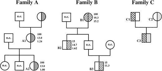 Fig. 4. Hematologic variables and phenotypic expression of 4.1R deficiency in families A and B. / Note the unusually low elliptocyte counts in heterozygous members of family B compared with the typical 100% hereditary elliptocytosis HE in heterozygous members of family A; n.e. indicates not examined. Family C, which was described previously,2324 is included for comparison. Numbers to right of circles and squares represent, in descending order, percent of elliptocytes; amount of hemoglobin, g/dL; and the reticulocyte count as a percentage of the whole blood cell population. □, normal 4.1R; ▥, 4.1R Fier; ▨, 4.1R Coimbra; ▧, uncharacterized 4.1R mutation; , 4.1R Presles.