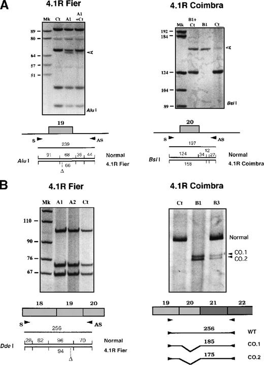 Fig. 6. Identification of 4.1R HE mutations. / (A) Identification of the genomic mutations by restriction digestion. In 4.1R Fier, the deletion neither creates nor abolishes a restriction site. (A1 + Ct) and (B1 + Ct) correspond to mixtures of patient and control DNAs. The restriction map is indicated at the bottom. Ct indicates control DNAs; and Mk, size markers. All sizes are in base pairs. (B) Reticulocyte 4.1R mRNA analysis. DdeI restriction digestion of RT-PCR product in 4.1R Fier revealed a single band that corresponds to the normal allele. In 4.1R Coimbra, RT-PCR amplification yielded 2 additional bands, CO.1 and CO.2, in the affected family members.