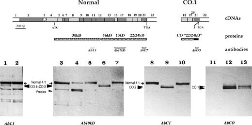 Fig. 8. Western blot analysis of membrane-associated 4.1R. / Schematic representation of erythroid domains and corresponding cDNA structure for the normal 4.1R and CO.1 missense C-terminal domain is shown. The asterisk indicates the premature termination codon in CO.1. Red cell membrane proteins were resolved with SDS-PAGE and transferred to a nitrocellulose membrane. Each sample corresponds to 20 μg of total membrane protein. The antibodies used in this set of Western blot studies are depicted beneath the structural domains, except that Ab4.1 epitopes are not indicated precisely because this polyclonal antibody was raised against the whole 80-kd isoform. The tested samples were as follows: heterozygous 4.1R Coimbra (family member B2: 1, 7, 10, and 13), homozygous 4.1R Coimbra (family member B1: 6, 9, and 12), heterozygous 4.1R Fier (family member A1: 5), heterozygous 4.1R Presles (4), and control membrane samples with normal 4.1R (2, 3, 8, and 11).