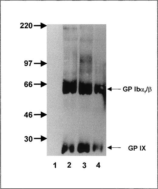 Fig. 2. Immunoprecipitation analysis of the GPIb-Ibβ-IX complex of Iya-phenotyped platelets after trypsin treatment. / Aliquots of 109 biotinylated platelets from an Iya-positive individual were treated with trypsin, washed, lysed, and immunoprecipitated with MAB SZ2 (lane 1), MAB Gi10 (lane 2), MAB Gi27 (lane 3), and anti-Iya antibodies (lane 4). Immunoprecipitates were analyzed with 7.5% SDS-PAGE under nonreducing conditions.