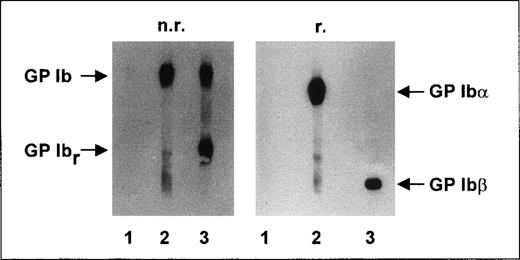 Fig. 3. Immunoblotting studies. / Aliquots of 109 washed platelets from an Iya-positive individual were lysed, and proteins were separated by using 7.5% SDS-PAGE under nonreducing (n.r.) and reducing (r.) conditions. After proteins were transferred to a nitrocellulose membrane, membrane strips were incubated with anti-Iyaantiserum (lane 1), MAB SZ2 (lane 2), and MAB Gi27 (lane 3). Antibody binding was detected by using corresponding peroxidase-conjugated antibodies and chemiluminescence substrate.