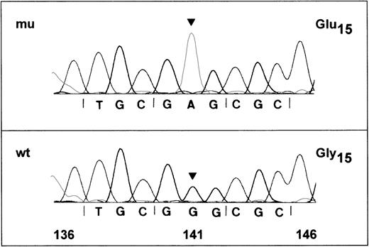 Fig. 4. DNA-sequence analysis of amplified GPIbβ gene of an Iya-positive individual. / Polymerase chain reaction (PCR) products of the GPIbβ gene encompassing nucleotides 47-563 were subcloned in the plasmid vector pGEM-5Zf and sequenced on both strands. Nucleotide-sequences of 2 positive clones are shown. (A) The wild-type G in position 141 is changed to an A (arrow), predicting a glycine to glutamic acid (GGG→GAG) polymorphism at position 15 of the mature glycoprotein. (B) The sequence is identical to the published wild-type sequence for GPIbβ.20