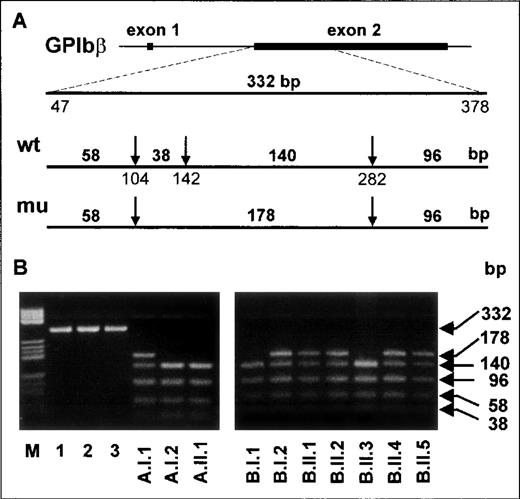 Fig. 6. PCR-restriction fragment length polymorphism analysis of Iya-phenotyped individuals with use ofNarI. / (A) A 332-base-pair product encompassing nucleotides 47-378 of theGPIbβ gene was obtained from genomic DNA by using primers GPIbβ 1 and GP Ibβ 3. The arrows indicate the cleavage sites recognized by the restriction endonuclease NarI. The length of the expected digested fragments from Iya-positive and Iya-negative alleles is also shown. (B) Analysis ofNarI-digested PCR products from genomic DNA of the members of the Iy family (left panel) and the Kr family (right panel). Lanes are inscribed according to the pedigrees (Figure 4). Undigested products from samples obtained from 3 individuals are shown in lanes 1 to 3 (left panel). In lane M, pBr 322 HaeIII DNA fragments are shown as standards.