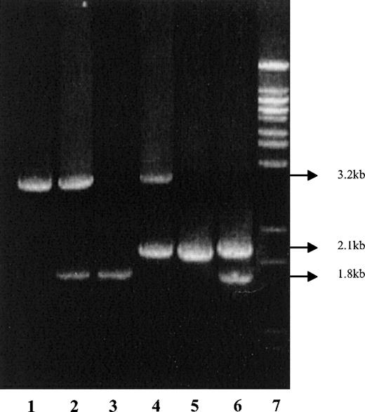 Fig. 2. Identification of amplification products by gel electrophoresis. / Lane 1: normal (αα/αα); 2: heterozygote −α3.7(−α3.7/αα); 3: homozygote −α3.7(−α3.7/−α3.7); 4: heterozygote −α4.2 (−α4.2/αα); 5: homozygote −α4.2 (−α4.2/−α4.2); 5: compound heterozygote −α3.7/−α4.2; and 7: molecular weight marker.