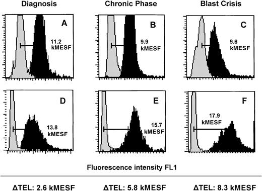 Fig. 3. Flow-FISH analysis of leukocytes and cultured T-lymphocytes from 3 representative individual patients with CML at different stages of the disease. / Total nucleated cells from peripheral blood (A and C) and bone marrow (B) as well as cultured T lymphocytes from the same specimen in each case (D-F) were analyzed with or without FITC-(C3TA2)3 PNA (respectively dark gray and light gray histograms). Total leukocytes (A-C) show shorter telomeres than the respective cultured T lymphocytes (D-F).