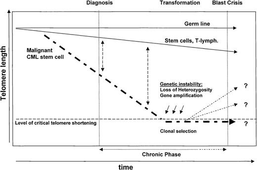 Fig. 5. Model of telomere biology in CML. / Note that telomeres are shorter in Ph+ cells as compared to Ph− normal cells at diagnosis compatible with a greater number of accumulated cell divisions in the Ph+stem cell clone. During CP, and with continued proliferation of the Ph+ stem cells, the differences in telomere length between Ph+ and Ph− cells are expected to become more pronounced. Eventually, the telomeres in the cells of the neoplastic clone become critically short. The resulting chromosomal instability may facilitate progression of the disease to AP/BP. Up-regulation of telomerase at this stage could eliminate telomere-related restrictions in cellular proliferation and is expected to prevent further telomere-mediated genetic instability.