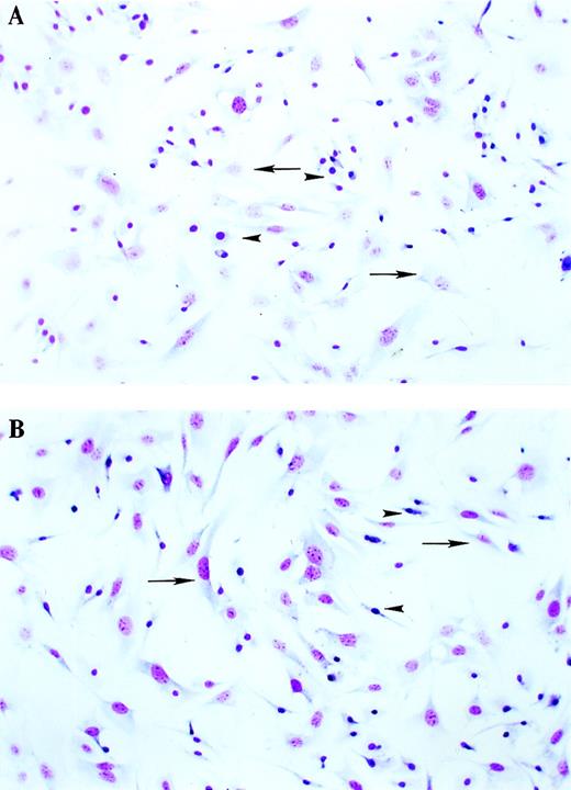 Fig. 1. Morphology of BMSCs from WT and TTP-deficient mice. / BMSCs were cultured for 6 weeks as described in “Materials and Methods.” After this period, the cells were trypsinized and replated at 50 000 cells/well in 4-well Lab-Tek tissue-culture chambers. After incubation for 48 hours, the slides were stained with the Diff-Qick Stain Set and photographed under light microscopy (60 × magnification). (A) WT cells. (B) TTP-deficient cells. Arrows indicate fibroblastlike cells, and arrowheads indicate macrophagelike cells.