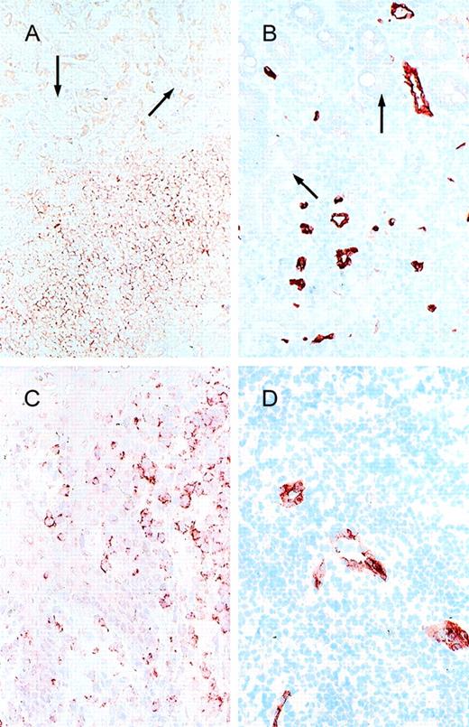 Fig. 3. Cell adhesion receptors and vascular addressins. / (A) α4β7 and (B) MAdCAM-1 expression in a low-grade B-cell lymphoma of MALT type (stomach; arrow, epithelial structures); (C) CLA and (D) E-selectin expression in a cutaneous T-cell lymphoma.