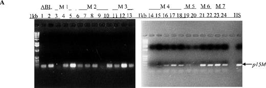 Fig. 1. Aberrant p15 methylation in adult and childhood acute leukemias. / (A) p15 methylation patterns in acute biphenotypic leukemia (ABL; lanes 1 and 2) and acute myeloid leukemia (AML; subtypes M1, M2, M3, M4, M5, M6, and M7 in lanes 3-24). DNA was amplified by using p15MF and p15MR primers. HS-Sultan DNA (HS) served as a methylated control. The 1-kilobase (kb) ladder is the molecular-weight standard. (B, C) Aberrantly methylated p15 sequences in blood plasma from patients with acute leukemia on ethidium bromide-stained agarose gels and Southern blots. Plasma DNA samples from patients withoutp15 methylation in blood cells or bone marrow are shown in lanes 1 to 4; samples from patients with p15 methylation in blood cells or bone marrow are shown in lanes 5 to 10. (D) p16methylation status in patients with AML (lanes 1-5) and acute lymphoblastic leukemia (ALL; lanes 6-10). DNA was amplified by using p16MF and p16MR primers.