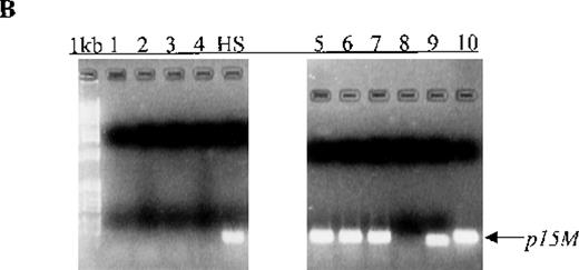 Fig. 1. Aberrant p15 methylation in adult and childhood acute leukemias. / (A) p15 methylation patterns in acute biphenotypic leukemia (ABL; lanes 1 and 2) and acute myeloid leukemia (AML; subtypes M1, M2, M3, M4, M5, M6, and M7 in lanes 3-24). DNA was amplified by using p15MF and p15MR primers. HS-Sultan DNA (HS) served as a methylated control. The 1-kilobase (kb) ladder is the molecular-weight standard. (B, C) Aberrantly methylated p15 sequences in blood plasma from patients with acute leukemia on ethidium bromide-stained agarose gels and Southern blots. Plasma DNA samples from patients withoutp15 methylation in blood cells or bone marrow are shown in lanes 1 to 4; samples from patients with p15 methylation in blood cells or bone marrow are shown in lanes 5 to 10. (D) p16methylation status in patients with AML (lanes 1-5) and acute lymphoblastic leukemia (ALL; lanes 6-10). DNA was amplified by using p16MF and p16MR primers.