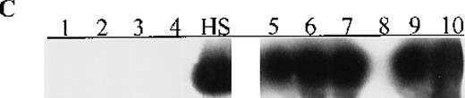 Fig. 1. Aberrant p15 methylation in adult and childhood acute leukemias. / (A) p15 methylation patterns in acute biphenotypic leukemia (ABL; lanes 1 and 2) and acute myeloid leukemia (AML; subtypes M1, M2, M3, M4, M5, M6, and M7 in lanes 3-24). DNA was amplified by using p15MF and p15MR primers. HS-Sultan DNA (HS) served as a methylated control. The 1-kilobase (kb) ladder is the molecular-weight standard. (B, C) Aberrantly methylated p15 sequences in blood plasma from patients with acute leukemia on ethidium bromide-stained agarose gels and Southern blots. Plasma DNA samples from patients withoutp15 methylation in blood cells or bone marrow are shown in lanes 1 to 4; samples from patients with p15 methylation in blood cells or bone marrow are shown in lanes 5 to 10. (D) p16methylation status in patients with AML (lanes 1-5) and acute lymphoblastic leukemia (ALL; lanes 6-10). DNA was amplified by using p16MF and p16MR primers.