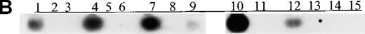 Fig. 3. Sequential monitoring of p15 methylation status in peripheral blood from patients with acute leukemia. / (A, B) Results on ethidium bromide-stained agarose gels and Southern blots for patients with L1, L2, M6, M3, and M7 subtypes at diagnosis (lanes 1, 4, 7, 10, and 12) or morphologic remission. The adult with the M6 subtype in whom active leukemia developed had methylatedp15 sequences (panel B, lane 9). The child with the M7 subtype had persistent unmethylated p15 status largely associated with morphologic remission and lack of residual leukemia for 3 months (lanes 13-15). (C, D) Results on agarose gels and Southern blots for patients with M2, ABL, and M4 subtypes at morphologic relapse, during active leukemia or residual leukemia, or in remission. HS-Sultan DNA (HS) served as a methylated control. The 1-kb ladder is the molecular-weight standard. The adult with M2 subtype had p15 methylation at diagnosis and relapse (lanes 1-2). The adult with ABL had p15methylation in association with morphologic relapse (lane 7) and the subsequent stage of active leukemia. p15 methylation was detected at morphologic remission in the adult with M4 subtype, who had relapse 2 weeks later (lanes 9-10).