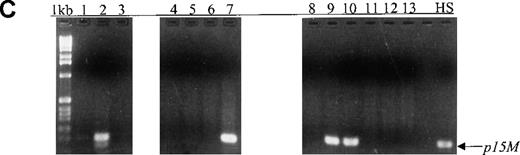 Fig. 3. Sequential monitoring of p15 methylation status in peripheral blood from patients with acute leukemia. / (A, B) Results on ethidium bromide-stained agarose gels and Southern blots for patients with L1, L2, M6, M3, and M7 subtypes at diagnosis (lanes 1, 4, 7, 10, and 12) or morphologic remission. The adult with the M6 subtype in whom active leukemia developed had methylatedp15 sequences (panel B, lane 9). The child with the M7 subtype had persistent unmethylated p15 status largely associated with morphologic remission and lack of residual leukemia for 3 months (lanes 13-15). (C, D) Results on agarose gels and Southern blots for patients with M2, ABL, and M4 subtypes at morphologic relapse, during active leukemia or residual leukemia, or in remission. HS-Sultan DNA (HS) served as a methylated control. The 1-kb ladder is the molecular-weight standard. The adult with M2 subtype had p15 methylation at diagnosis and relapse (lanes 1-2). The adult with ABL had p15methylation in association with morphologic relapse (lane 7) and the subsequent stage of active leukemia. p15 methylation was detected at morphologic remission in the adult with M4 subtype, who had relapse 2 weeks later (lanes 9-10).