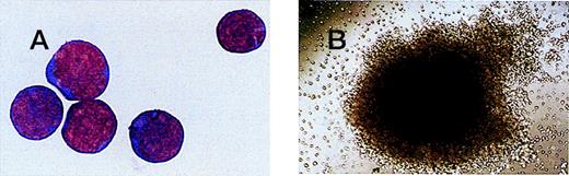 Fig. 1. Magnetically sorted CD34+ cells and a CFU-GEMM colony from fetal blood. / (A) CD34+ cells magnetically sorted from a 12+0 week fetal blood sample and stained with Leishman's stain (original magnification × 100). (B) CFU-GEMM colony grown from a 7+6 week fetal blood sample (original magnification × 10).