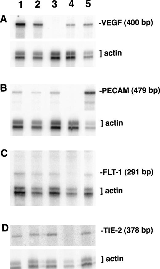 Fig. 3. RNA protection analysis of VEGF mutant ES cell cultures. / Total RNA from cultures on day 8 of differentiation was hybridized with the indicated 32P-labeled probes and a β-actin probe as described in “Materials and methods.” After separation on a polyacrylamide–urea gel, protected fragments were visualized and quantitated using a PhosphorImager. Lane 1, VEGF (+/+) ES culture RNA; lane 2, VEGF (+/−) ES culture RNA; lane 3, VEGF (−/−) ES culture RNA; lane 4, NIH 3T3 fibroblast cell line RNA; lane 5, Py-4-1 endothelial cell line RNA. (A) Protection with antisense VEGF probe. (B) Protection with antisense PECAM probe. (C) Protection with antisense flt-1 probe. (D) Protection with antisense tie-2/tek probe.