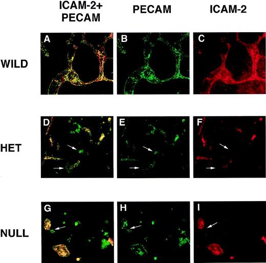 Fig. 5. PECAM/ICAM-2 double-label immunofluorescent antibody staining of VEGF mutant ES cultures. / Day 8 cultures were fixed and stained with rat antimouse ICAM-2 (red) and rabbit polyclonal antimouse PECAM (green) antibodies, along with the appropriate secondary antibodies. Images were photographed with the appropriate FITC (B, E, H) or rhodamine (C, F, I) filters or with a double exposure using both filters sequentially (A, D, G). (A-C) Wild-type (+/+) VEGF ES cultures. (D-F) Hemizygous (+/−) VEGF mutant ES cell cultures. (G-I) Null (−/−) VEGF mutant ES cultures. The arrows in (D-I) point to clumps of cells that stain with the PECAM antibody but not with the ICAM-2 antibody. Magnification, 50×.