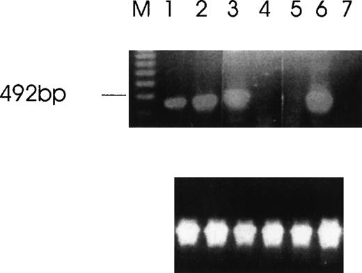 Fig. 1. Detection of Ang-1 mRNA expression by RT-PCR with primers designed to give a 429-bp product. / Ethidium bromide-stained agarose gel with RT-PCR products from MDA-MB231 cells (lane 1), MDA-MB468 (lane 2), FS4 (lane 3), MCF7 (lane 4), DU145 (lane 5), CHRF (lane 6), and negative control (absence of cDNA template) (lane 7). The amplification of β-actin was used as an internal control (lower panel).