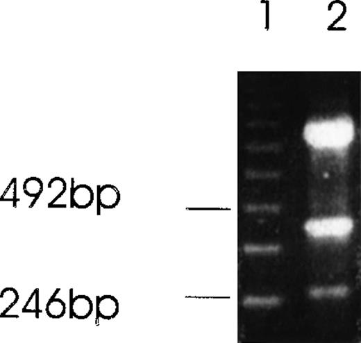 Fig. 2. Alternatively spliced species of Ang-1 mRNA in CHRF cells detected by RT-PCR analysis. / Two isoforms of Ang-1 can be detected simultaneously that give rise to single bands at 429 bp and 262 bp (lane 2), representing full-length Ang-1.5 kb and an alternatively spliced 1.3-kb isoform, respectively. The top band is β-actin.