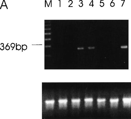 Fig. 5. RT-PCR of tumor cells with primers designed to detect specific isoforms using the 5′ primer to straddle the splice junction site. / (A) An alternatively spliced species of Ang-1 mRNA in cells, determined by RT-PCR with a set of primers used to detect Ang-1 isoform 1.3 kb and designed to detect a 312-bp product. Lane 1, negative control without cDNA template; lane 2, DU145; lane 3, FS4; lane 4, MDA-MB468; lane 5, MDA-MB231; lane 6, MCF7; lane 7, CHRF. (B) Primers designed to detect the 0.9- and 0.7-kb isoforms, which give rise to corresponding bands 595 bp and 428 bp, respectively, in CHRF cells.