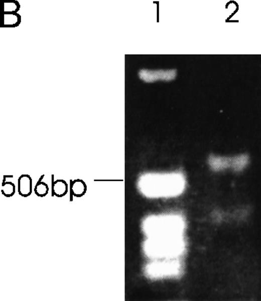 Fig. 5. RT-PCR of tumor cells with primers designed to detect specific isoforms using the 5′ primer to straddle the splice junction site. / (A) An alternatively spliced species of Ang-1 mRNA in cells, determined by RT-PCR with a set of primers used to detect Ang-1 isoform 1.3 kb and designed to detect a 312-bp product. Lane 1, negative control without cDNA template; lane 2, DU145; lane 3, FS4; lane 4, MDA-MB468; lane 5, MDA-MB231; lane 6, MCF7; lane 7, CHRF. (B) Primers designed to detect the 0.9- and 0.7-kb isoforms, which give rise to corresponding bands 595 bp and 428 bp, respectively, in CHRF cells.