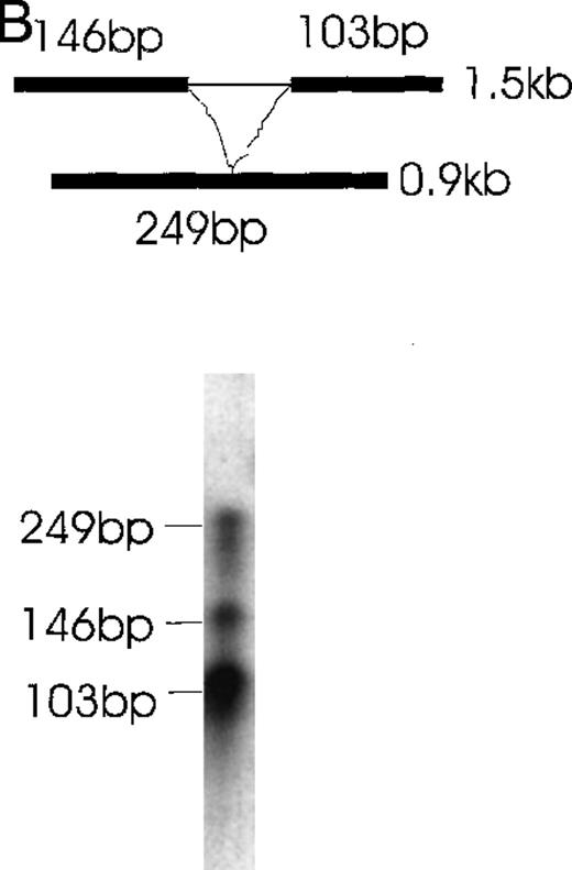 Fig. 6. Simultaneous detection of the alternatively spliced mRNA species of Ang-1 in CHRF cells by RNase protection assay. / Schematic diagrams of the strategy for determining the alternatively spliced mRNA of Ang-1 are shown on the upper panels of A and B. The thick lines represent fragments derived from various forms of Ang-1 that could be detected by this assay. The alternatively spliced parts of Ang-1 are shown as thin lines. (A) The designed 262-bp antisense probe is derived from the 1.3-kb isoform. Lane 1 shows the RNase-protected 262-bp product, indicating the presence of the 1.3-kb isoform and the 219-bp product representing the 1.5-kb and 0.9-kb isoforms. The 43-bp fragment (not shown) is small and seen only after a longer time exposure. Lane 2 shows the RNA extracted from DU145 cells as a negative control. (B) The designed 249-bp antisense probe is derived from the 0.9-kb isoform. The detected 249-bp band indicates the presence of the 0.9-kb isoform. The 146-bp and 103-bp bands represent the 1.5-kb or 1.3-kb isoforms.
