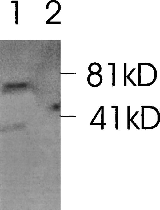 Fig. 8. Western immunoblot of 2 Ang-1 isoforms. / CHRF cells were lysed, electrophoresed in 12% SDS-PAGE, transferred to nylon membranes, and immunoblotted with rabbit anti-Ang-1. Lane 1, CHRF cells; lane 2, DU145 cells. Protein marker sizes are shown on the right.