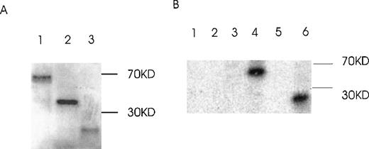 Fig. 9. Binding of Ang-1 isoforms to Tie-2 by ligand–receptor precipitation. / (A) In vitro translated radioactive proteins of isoform 1.5 kb (lane 1), 1.3 kb (lane 2), and 0.9 kb (lane 3) are shown. (B) In vitro translated proteins were incubated with Tie-2-Fc, 1 μg/mL, and precipitated with protein G beads. After washing and elution, samples were discriminated by SDS-PAGE plus autoradiography. Lane 1, 2, and 3 (1.5-, 1.3-, and 0.9-kb isoforms, respectively, with protein G beads alone). Lanes 4, 5, and 6 (1.5-, 1.3-, and 0.9-kb isoforms, respectively, with Tie-2-Fc plus protein G beads. No immunoprecipitation was noted with the 1.3-kb isoform (lane 5) or with control 35S-luciferase (Tie-2-Fc plus protein G beads; data not shown).