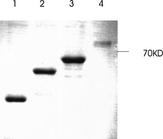 Fig. 10. Production and purification of recombinant GST-fusion proteins of Ang-1 isoforms. / Recombinant proteins were purified from bacterial lysates by glutathione Sepharose 4B chromatography and analyzed by SDS-PAGE followed by Coomassie blue staining. The expected molecular weights of fusion proteins were obtained and purified to near homogeneity by this procedure. Lanes 1, 2, 3, and 4 (0.7-, 9.9-, 1.3-, and 1.5-kb isoforms, respectively).