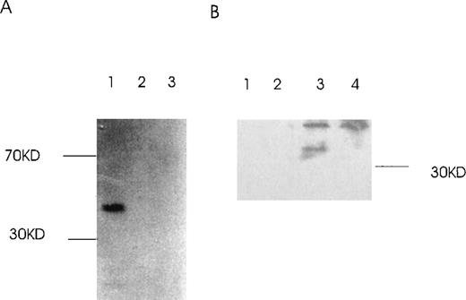 Fig. 11. Binding of Ang-1.3-kb isoform protein to 1.5-kb isoform protein in vitro. / (A) The GST–Ang-1.5-kb fusion protein was incubated with35S-labeled 1.3 kb, 0.9 kb, or luciferase prepared by transcription/translation in vitro. Proteins bound to the 1.5-kb fusion protein were identified by incubation with glutathione Sepharose 4B beads, elution, electrophoresis on 12% SDS-PAGE, and autoradiography of the gel. Lane 1 (1.3 kb), lane 2 (0.9 kb), lane 3 (control luciferase protein). (B) cos cells were transfected with either a mixture of 1.5 and 1.3 kb containing vectors or 1.5-kb vector alone. Cells were lysed in lysis buffer, and isoforms were precipitated with or without antibody reactive with the 1.5-kb isoform, not the 1.3-kb isoform, plus protein G beads. Samples were then analyzed by Western blot with an antibody reactive with both the 1.5- and the 1.3-kb isoforms. Lane 1, 1.5- and 1.3-kb transfectant without antibody but with protein G beads; lane 2, 1.5-kb transfectant without antibody but with beads; lane 3, 1.5- and 1.3-kb transfectant with antibody plus beads; lane 4, 1.5-kb transfectant with antibody plus beads.
