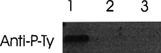 Fig. 12. Induction of autophosphorylation of Tie-2 receptor by Ang-1 isoforms. / HUVE cells were stimulated with conditioned media collected from Ang-1 isoforms (Ang-1.5 kb, lane 1; 1.3 kb, lane 2; or 0.9 kb, lane 3) in transfected COS cells. Cell lysates were immunoprecipitated with anti-Tie-2 antibody. Immunoprecipitates were analyzed by Western blot with antiphosphotyrosine antibody.