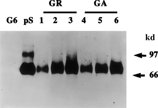 Fig. 1. Protein S production by growing and growth-arrested human vascular smooth muscle cells (HVSMCs). / Protein S production was assessed in conditioned media. Two cell culture conditions were used: growth-arrested (GA) and growing (GR) cells. Growth-arrested cells were obtained by transferring 90% confluent cultures into serum-free Dulbecco's modified Eagle's medium (DMEM) for 48 hours prior to the commencement of media conditioning. Growing cells, were subconfluent cultures (60% confluency) that were placed in a defined growth promoting serum-free medium at the start of media conditioning. Conditioned media were collected after 24 hours (lanes 1, 4), 48 hours (lanes 2, 5), and 72 hours (lanes 3, 6) and were analyzed by Western blotting using a rabbit anti-protein S antibody. Purified 1 ng protein S (pS) and 50 ng recombinant human growth arrest specific protein 6 (G6) were included as controls.