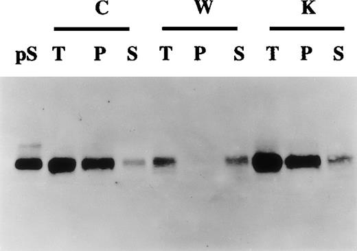 Fig. 4. Production of γ-carboxylated protein S by human vascular smooth muscle cells (HVSMCs). / Conditioned media collected from 90% confluent HVSMC cultures maintained in either control (C), warfarin (1 μg/mL) (W), or vitamin K (1 μg/mL) (K) for 72 hours were subjected to barium citrate precipitation as described in “Materials and methods.” Aliquots from total unprecipitated (T), barium citrate precipitated (P), and nonprecipitable supernatant fractions (S) were analyzed by Western blotting using an anti-protein S polyclonal antibody. Protein S (1 ng) (pS) was used as a control.