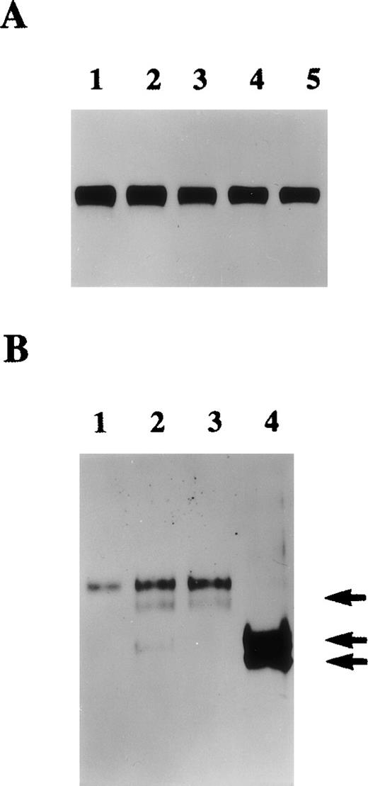 Fig. 5. Regulation of protein S synthesis by growth factors and thrombin. / A. Conditioned media collected from 90% confluent human vascular smooth muscle cell (HVSMC) cultures maintained in serum-free medium for 48 hours in the presence of either control (lane 1), 5 ng/mL basic fibroblast growth factor (b-FGF) (lane 2), 2 ng/mL transforming growth factor beta-1 (TGF-β)1 (lane 3), 5 ng/mL hepatocyte growth factor (HGF) (lane 4), or 5 ng/mL platelet-derived growth factor-BB (PDGF-BB) (lane 5) were analyzed by Western blotting using an anti-protein S polyclonal antibody. B. Conditioned media were collected from 90% confluent cultures maintained in serum-free medium for 24 hours in the presence of either control (lane 1), α-thrombin at either 0.5 U/mL (lane 2), 1 U/mL (lane 3), or 5 U/mL (lane 4). Conditioned media were analyzed by Western blotting using an anti-protein S polyclonal antibody. Arrows indicate cleaved forms of protein S.