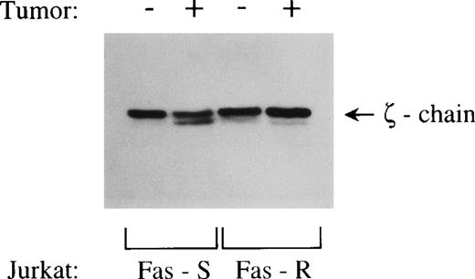 Fig. 10. Tumor-induced ζ-chain cleavage in Jurkat cells. / Fas-sensitive and Fas-resistant Jurkat cells were coincubated with tumor cells for 16 hours at a tumor-to-lymphocyte cell ratio of 20:1. Jurkat cells were then negatively selected by removal of tumor cells with the use of epithelial-specific anti-α6β4 mAb and magnetic beads. Negatively selected Jurkat cells were lysed and analyzed by Western blotting for expression of ζ-chain. N-terminus–specific anti-ζ Ab was used for probing.