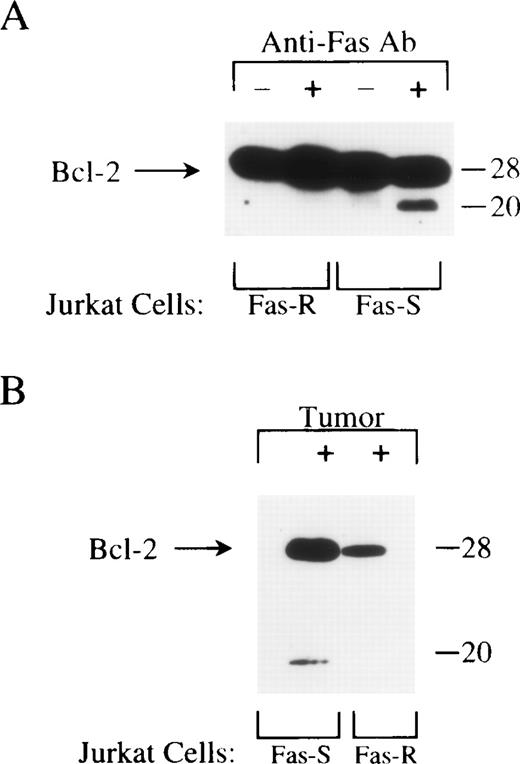 Fig. 12. Cleavage of Bcl-2 in Jurkat cells treated with agonistic anti-Fas Ab or coincubated with tumor cells. / In (A), Fas-sensitive and Fas-resistant Jurkat cells were treated with CH-11 (200 ng/mL) for 16 hours. At the end of the incubation period, the cells were lysed and assessed by Western blotting for Bcl-2 expression (anti–Bcl-2 mAb 100, Santa Cruz). In (B), Fas-sensitive and Fas-resistant Jurkat cells were coincubated with tumor cell (20:1 tumor-to-Jurkat cell ratio) for 16 hours. At the end of the coincubation period, Jurkat lymphocytes were negatively selected by removal of tumor cells, using epithelial-specific anti-α6β4 mAb and magnetic beads. Negatively selected Jurkat cells were lysed and analyzed by Western blotting for expression of Bcl-2. Better separation between the Bcl-2 bands was observed in B than in A, owing to longer electrophoresis.