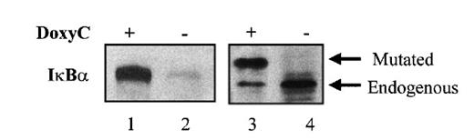 Figure 4. Gel electrophoresis with or without stacking gel followed by Western blot analysis of IκBα32/36A. MS4A-IκBα32/36A-transfected cells were (lanes 1 and 3) or were not (lanes 2 and 4) treated with doxycycline for 48 hours. SDS–PAGE and Western blot detection of IκBα was performed without (lanes 1 and 2) or with (lanes 3 and 4) stacking gel.