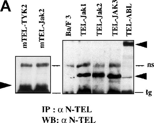 Fig. 2. Phosphotyrosine immunoblot analysis of the IL-3 receptor β subunit and of cellular proteins in TEL-JAK- and TEL-ABL-expressing cells. / (A) The expression of stably transfected TEL-JAK and TEL-ABL fusions in the indicated IL-3-independent Ba/F3 cell lines was evaluated by immunoprecipitation (IP) followed by Western blotting (WB) using a polyclonal rabbit immune serum raised against the amino-terminal part (α N-TEL) of the human TEL protein. Immunoprecipitated complexes are indicated by black arrows; ns, nonspecific. Predicted molecular weights of the chimera are as follows: TEL-Jak1, 75.5 kd; TEL-Jak2, 77.7 kd; TEL-JAK3, 79.3 kd; TEL-ABL, 158.8 kd; murine TEL-Jak2, 50.5 kd; murine TEL-TYK2, 49.4 kd. (B) The IL-3βR subunit was immunoprecipitated from total cell lysates of the indicated IL-3-independent Ba/F3 cell lines and analyzed by immunoblotting with an antiphosphotyrosine antibody (α pTyr). The blot was stripped and reprobed with an anti-IL-3βR antibody. (C) Total cell lysates of the indicated IL-3-independent Ba/F3 cells were subjected to Western blotting using an antiphosphotyrosine antibody. As a control, total cell lysates of parental Ba/F3 cells, starved then stimulated with mIL-3, were loaded. Differences in patterns of cellular protein phosphorylations were reproducibly observed between TEL-JAK- and TEL-ABL-expressing Ba/F3 cells. Note that the weaker pattern of phosphorylation seen in the mTEL-Jak2 line is due to underloading of total cell lysates.