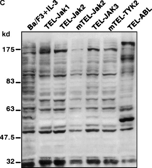 Fig. 2. Phosphotyrosine immunoblot analysis of the IL-3 receptor β subunit and of cellular proteins in TEL-JAK- and TEL-ABL-expressing cells. / (A) The expression of stably transfected TEL-JAK and TEL-ABL fusions in the indicated IL-3-independent Ba/F3 cell lines was evaluated by immunoprecipitation (IP) followed by Western blotting (WB) using a polyclonal rabbit immune serum raised against the amino-terminal part (α N-TEL) of the human TEL protein. Immunoprecipitated complexes are indicated by black arrows; ns, nonspecific. Predicted molecular weights of the chimera are as follows: TEL-Jak1, 75.5 kd; TEL-Jak2, 77.7 kd; TEL-JAK3, 79.3 kd; TEL-ABL, 158.8 kd; murine TEL-Jak2, 50.5 kd; murine TEL-TYK2, 49.4 kd. (B) The IL-3βR subunit was immunoprecipitated from total cell lysates of the indicated IL-3-independent Ba/F3 cell lines and analyzed by immunoblotting with an antiphosphotyrosine antibody (α pTyr). The blot was stripped and reprobed with an anti-IL-3βR antibody. (C) Total cell lysates of the indicated IL-3-independent Ba/F3 cells were subjected to Western blotting using an antiphosphotyrosine antibody. As a control, total cell lysates of parental Ba/F3 cells, starved then stimulated with mIL-3, were loaded. Differences in patterns of cellular protein phosphorylations were reproducibly observed between TEL-JAK- and TEL-ABL-expressing Ba/F3 cells. Note that the weaker pattern of phosphorylation seen in the mTEL-Jak2 line is due to underloading of total cell lysates.