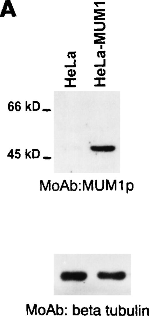 Fig. 1. Western blotting with the MUM1p monoclonal antibody. / (A) A band of 52-kd of the expected size of the MUM1-HA protein is seen in line corresponding to pHeBo-CMV-MUM1-HA HeLa-transfected cells but not in negative control HeLa cells. (B) A 50-kd band of the expected molecular size of the MUM1 protein is seen in lanes 2 and 4, corresponding to the IM9 myeloma cell line and normal tonsil. No bands are detected in lanes 1 and 3, corresponding to U937 and HeLa cell lines. Identical results (not shown) were obtained with the monoclonal (clone MUM97) and polyclonal anti-IRF4/ICSAT antibody. In both experiments, β tubulin levels are shown below to control for the integrity and amount of the loaded protein.
