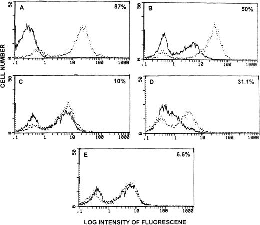 Fig. 4. Detection of functional sFasL in the serum of tumor-bearing mice. / (A) Freshly isolated thymocytes from C57BL/6 +/+ mice stained with TdT + FITC-dUTP (bold histogram) or stained after irradiation and culture for 24 hours (broken histogram). (B-E) Thymocytes from C57BL/6 +/+ (B, D) or C57BL/6 lpr/lpr mice (C, E) were cultured in the presence of sera from PBS-treated control mice (bold histogram) or from tumor-bearing mice (broken histogram). Cells were analyzed for green fluorescence using a flow cytometer. The subtraction of broken histogram from the bold histogram has been indicated as the percentage apoptosis in each panel.