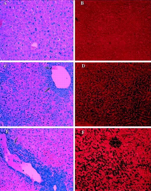 Fig. 5. Analysis of morphology and apoptosis in the liver of tumor-bearing C57BL/6 +/+ mice. / Sections of liver from PBS-injected control mice (A, B), LSA tumor-bearing (C, D), or EL-4 tumor-bearing (E, F) mice were examined after H&E staining (A, C, E) or TUNEL assay (B, D, F) to detect apoptosis. Small and large arrows represent infiltration of tumor cells and lymphocytes, respectively. Dark purple staining in D and F indicates the apoptosis.